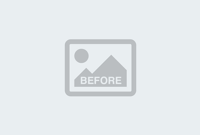 Before Image: Labiaplasty - back