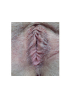 Before Image: Vaginoplasty - front
