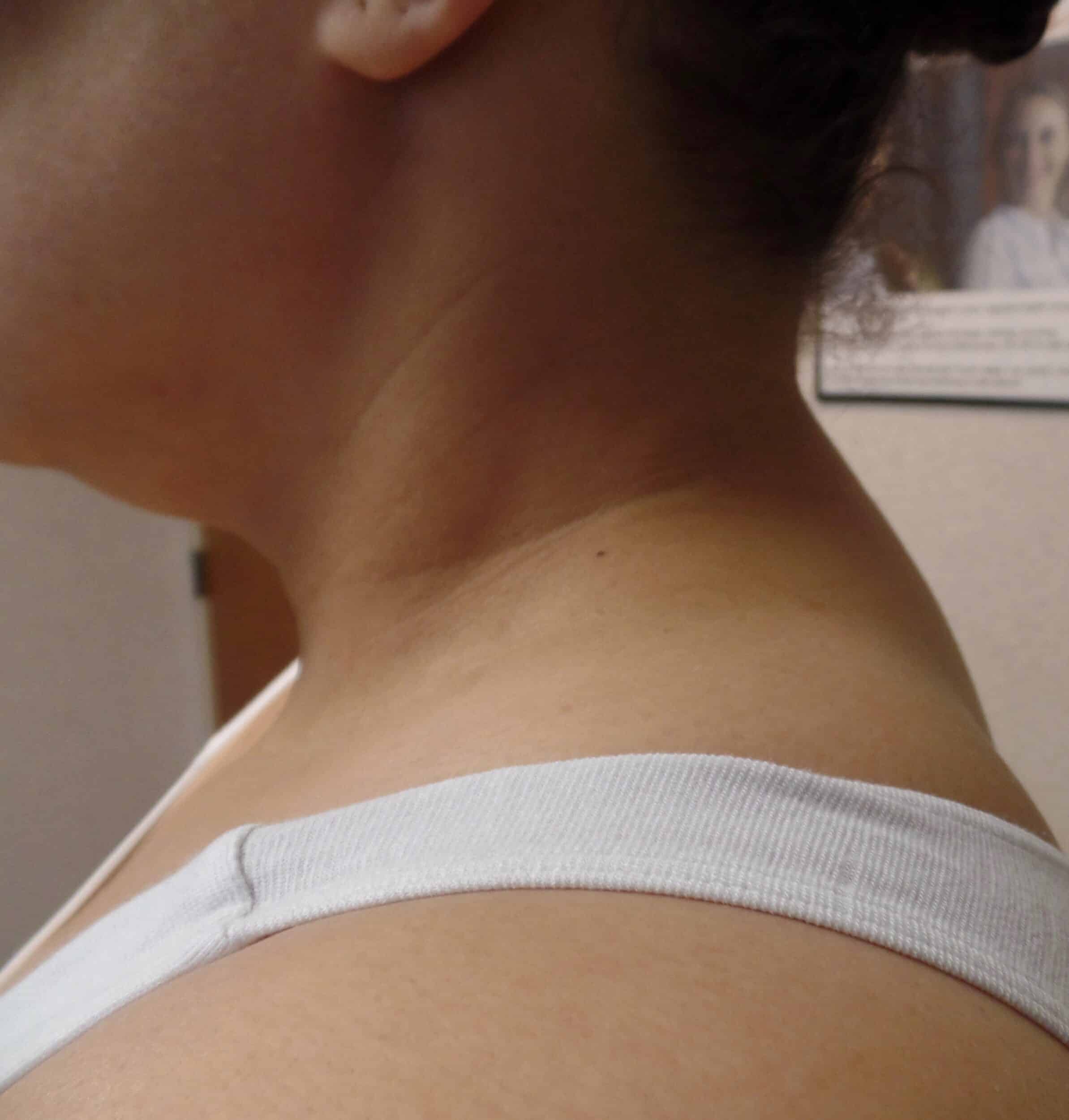 After Image: Buffalo Hump - left-side