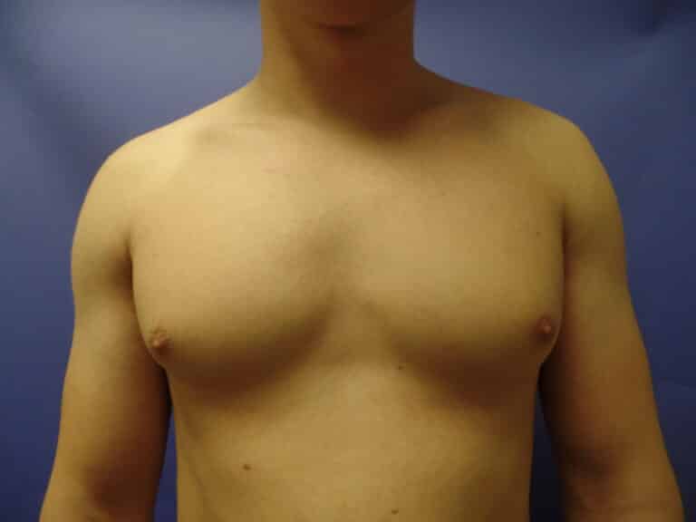 Before Image
