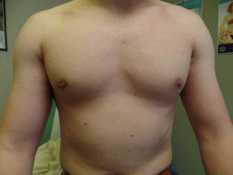 After Image