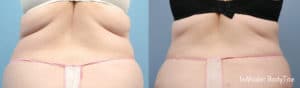 accutite combo post 1 1 1 300x300 1 im sm back 300x88 1