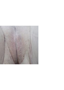 After Image