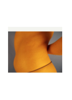 Liposuction