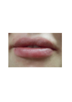 Filler