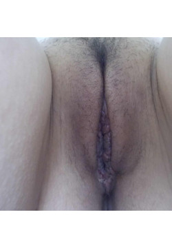 LABIAPLASTY