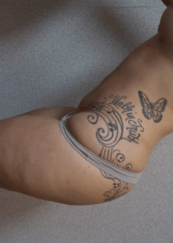 LIPOSUCTION 360